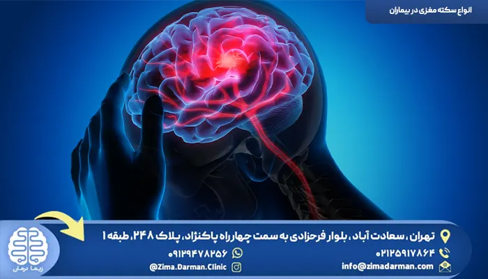 انواع سکته مغزی در بیماران