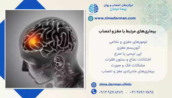 بیماری‌های مرتبط با مغز و اعصاب