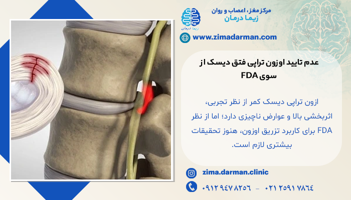 اوزون تراپی دیسک کمر | نظرات مردم درباره اوزون تراپی چیست؟