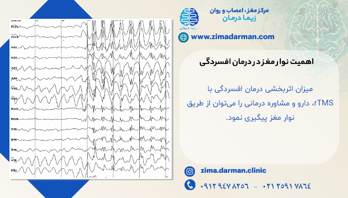 اهمیت نوار مغز در درمان افسردگی
