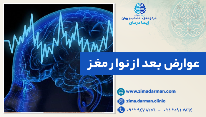 عوارض بعد از نوار مغز | مهم‌ترین عیب‌های EEG
