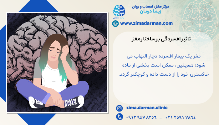 تاثیر افسردگی بر ساختار مغز