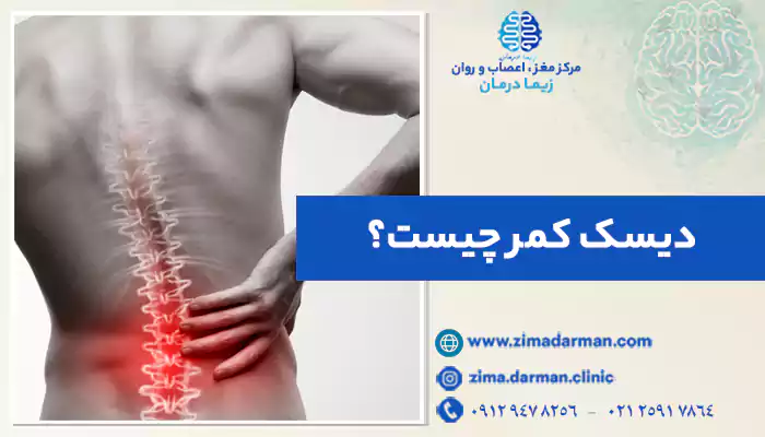 دیسک کمر چیست؟ | پیشگیری و علائم خطر فتق دیسک کمر و بیرون زدگی دیسک کمر