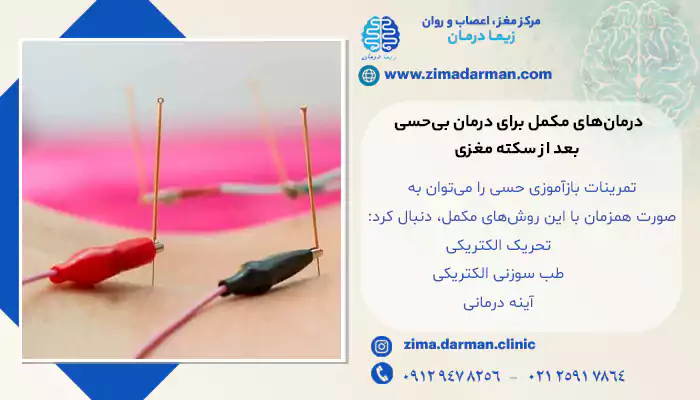 استفاده از طب سوزنی الکتریکی برای توانبخشی و بازگشت بی حسی بعد از سکته