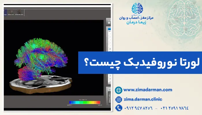 تصویر 3 بعدی از لورتا نوروفیدبک