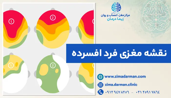 تصویری از نقشه مغزی فرد افسرده | نقشه مغزی فرد افسرده چگونه است؟ بررسی نقشه مغزی افسردگی