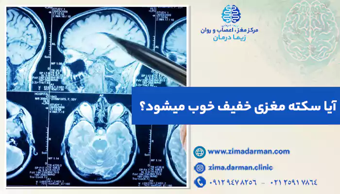 عکس CT Scan یک بیمار دچار سکته مغزی خفیف