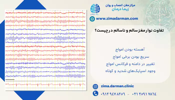 بررسی تفاوت نوار مغزی سالم و ناسالم در انواع بیماری ها