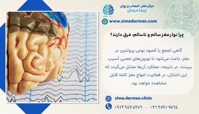 چرا نوار مغز افراد سالم و بیمار متفاوت است؟