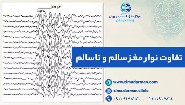 نوار مغز سالم با ناسالم چه فرقی دارد؟