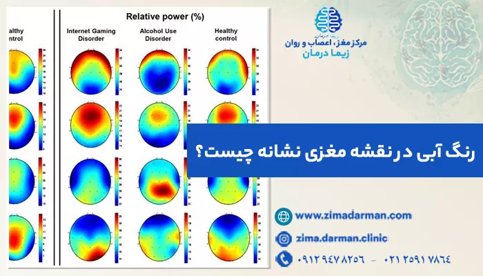 تصویر رنگ آبی در نقشه مغزی