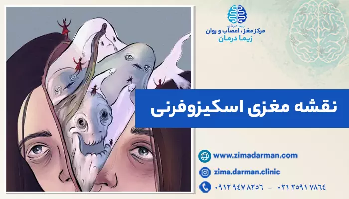 تصویری نمادین از ذهن فرد مبتلا به اسکیزوفرنی | نقشه مغزی اسکیزوفرنی