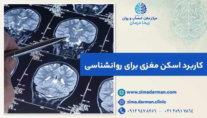 کاربرد اسکن مغزی برای روانشناسی | 8 مزایای دستگاه اسکن مغز