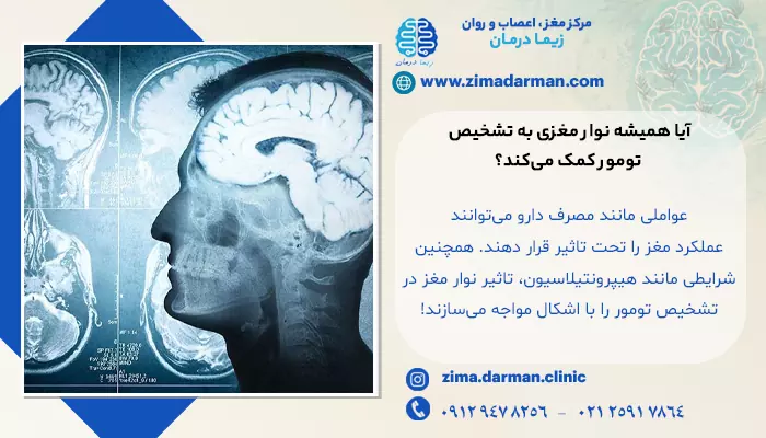 عکس تومور مغزی، آیا نوار مغز تومور را نشان می دهد؟ | EEG برای تشخیص تومور