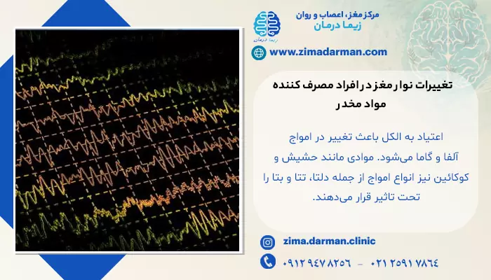 تصویر نوار مغز فرد معتاد؛ آیا نوار مغز اعتیاد را نشان می دهد؟ | تشخیص اعتیاد با نوار مغز