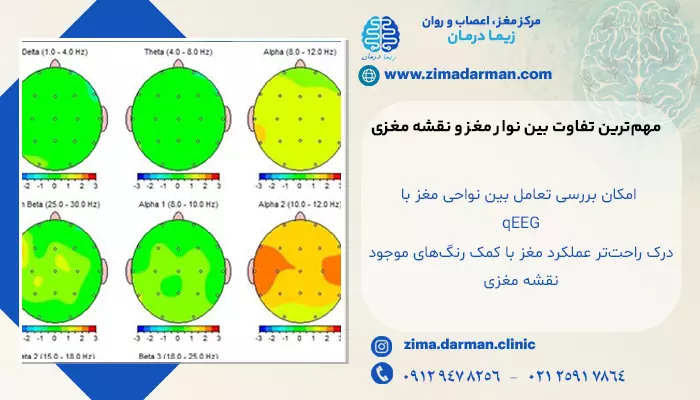 تصویر تفاوت نوار مغز و نقشه مغزی | کدام برای تشخیص دقیق تر است؟