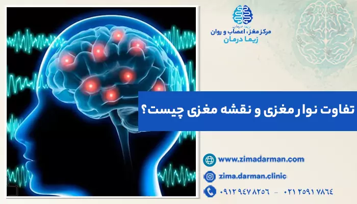 تصویر سیگنال های مغزی؛ تفاوت نقشه مغزی و نوار مغزی چیست؟ بررسی فرق نقشه مغزی با نوار مغزی