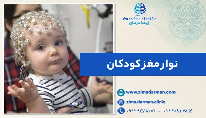 8 نکته ضروری درباره نوار مغز کودکان | بررسی روش گرفتن نوار مغز از کودکان