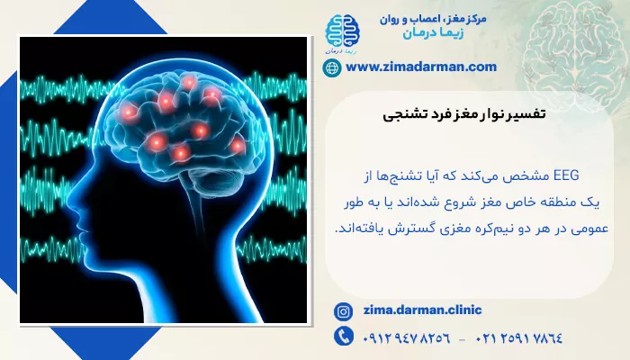 تفسیر نوار مغز فرد تشنجی
