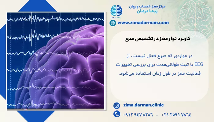 کاربرد نوار مغز در تشخیص صرع