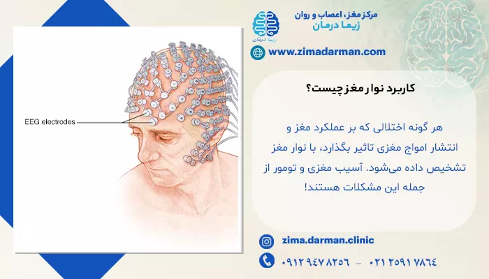 تصویر شماتیک نحوه انجام نوار مغز و توضیح کاربردهای آن