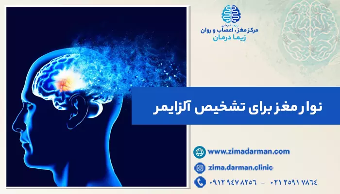 تشخیص آلزایمر با نوار مغز | چطور AD با EGG قابل شناسایی است؟