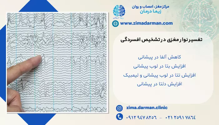 تفسیر نوار مغزی در تشخیص افسردگی