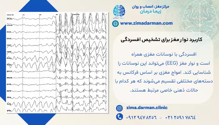 کاربرد نوار مغز برای تشخیص افسردگی