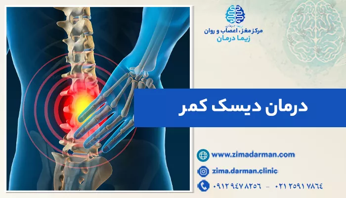 بهترین روش درمان قطعی دیسک کمر چیست؟