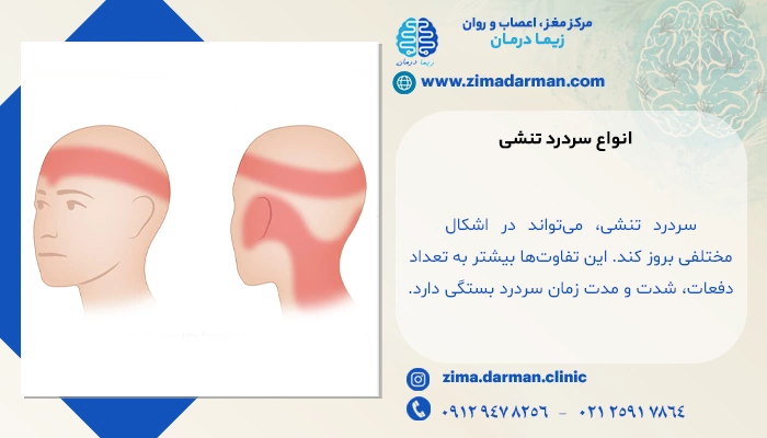 انواع سردرد تنشی: از اپیزودیک تا مزمن