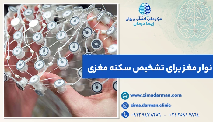 نوار مغز برای تشخیص سکته مغزی؛ آیا موثر است؟ بررسی ارتباط الکتروانسفالوگرام و سکته مغزی