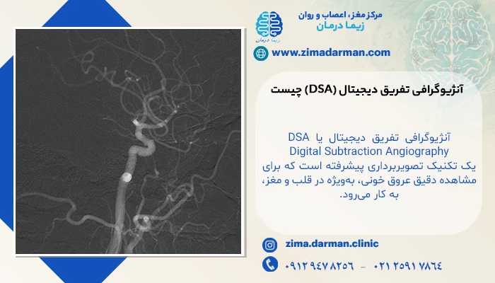 آنژیوگرافی تفریق دیجیتال (DSA) چیست و چگونه کار میکند؟