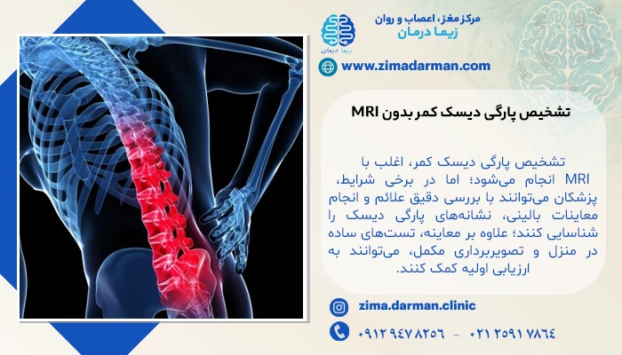 علائم شایع پارگی دیسک کمر | اصلیترین علائم دیسک کمر کدامند؟
