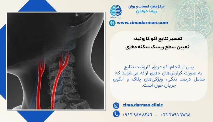 تفسیر نتایج اکو کاروتید: تعیین سطح ریسک سکته مغزی