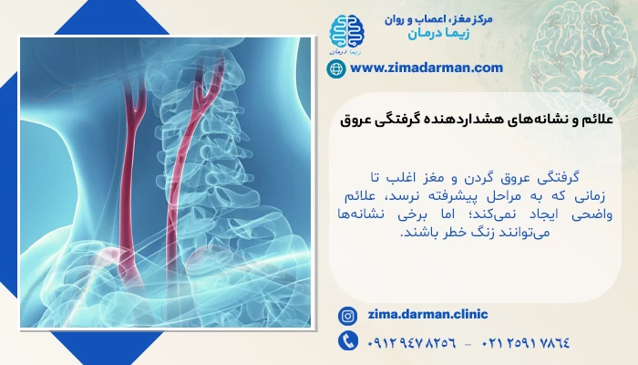 علائم اکو داپلر عروق گردن | تشخیص بیماری عروقی با اکو عروق گردن