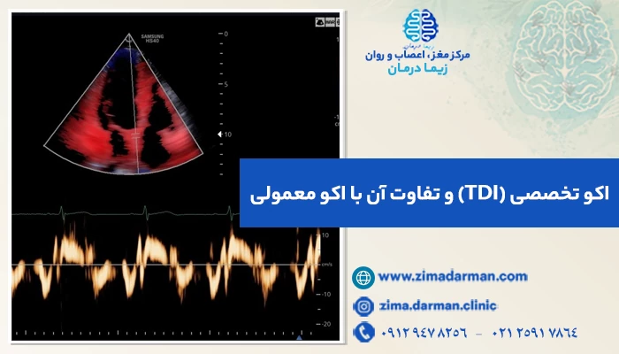 اکو تخصصی (TDI) و تفاوت آن با اکو معمولی | مزایای اکوی تخصصی قلب