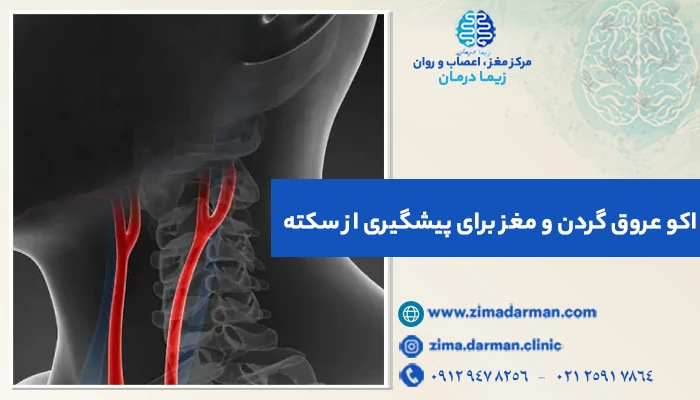 اکو عروق گردن و مغز برای پیشگیری از سکته | اکو داپلر عروق گردن