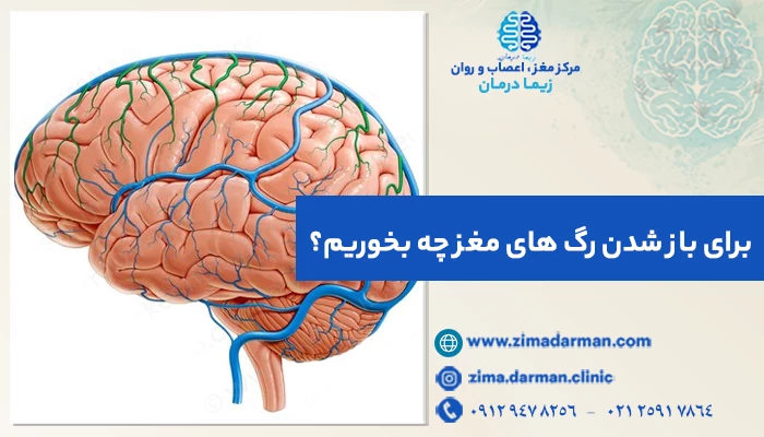 برای باز شدن رگهای مغز چه بخوریم؟ درمان گرفتگی رگ های مغز