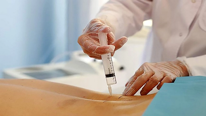 هزینه اوزون تراپی دیسک کمر | قیمت آمپول اوزون برای دیسک کمر چقدر است؟